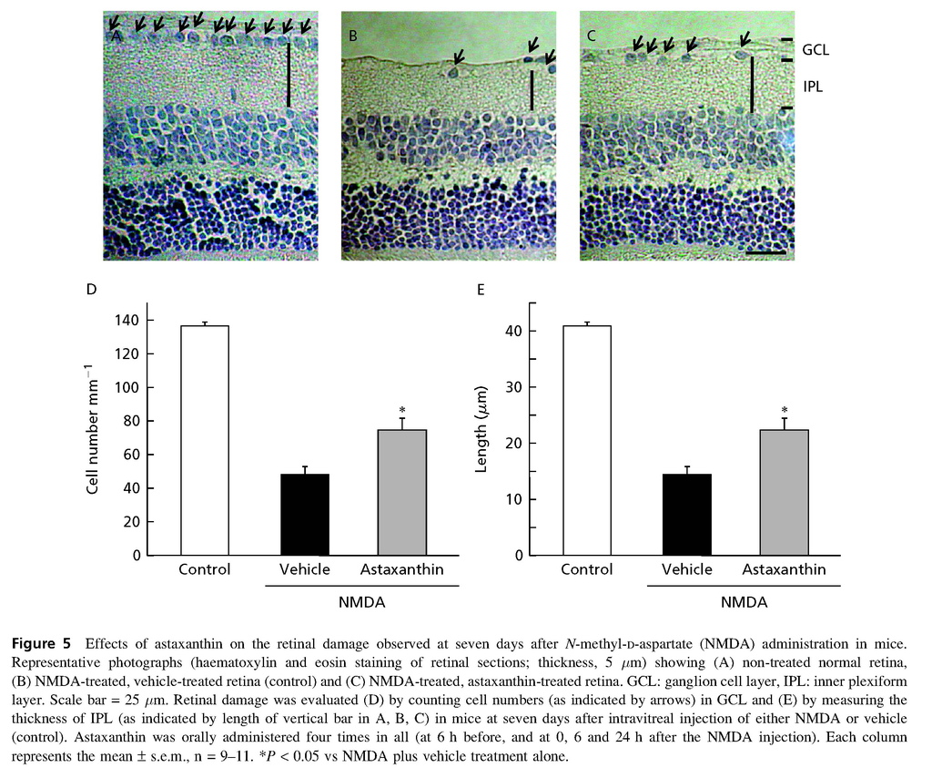 Astaxanthin, a dietary carotenoid, protects retinal cells against oxidative stress in-vitro and in mice in-vivo_頁面_07.jpg Astaxanthin, a dietary carotenoid, protects retinal cells against oxidative stress in-vitro and in mice in-vivo_頁面_07.jpg
