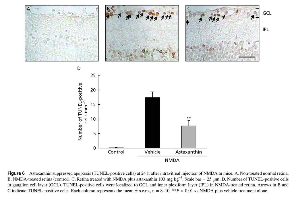 Astaxanthin, a dietary carotenoid, protects retinal cells against oxidative stress in-vitro and in mice in-vivo_頁面_08 - 複製.jpg Astaxanthin, a dietary carotenoid, protects retinal cells against oxidative stress in-vitro and in mice in-vivo_頁面_08 - 複製.jpg