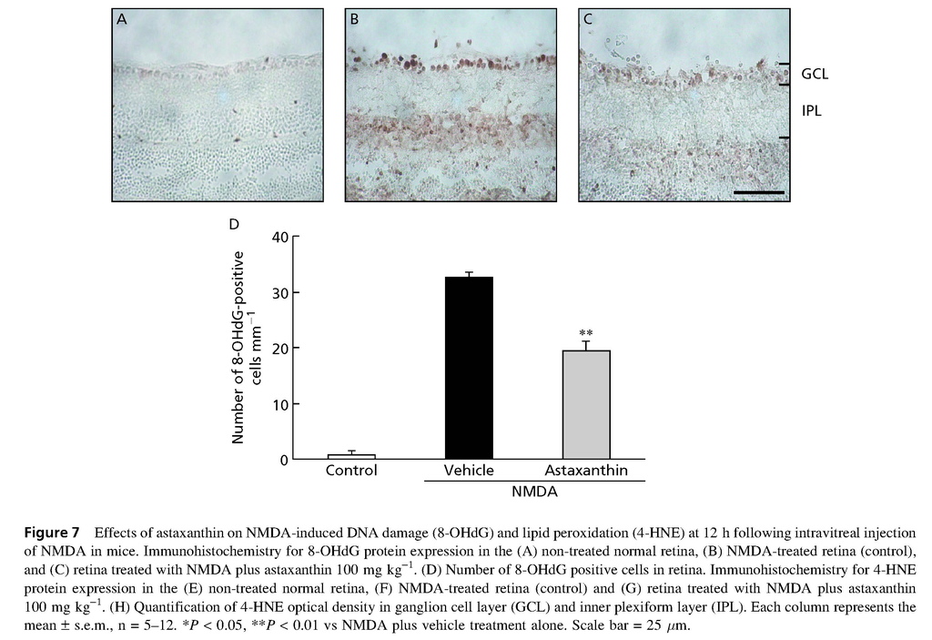 Astaxanthin, a dietary carotenoid, protects retinal cells against oxidative stress in-vitro and in mice in-vivo_頁面_08.jpg Astaxanthin, a dietary carotenoid, protects retinal cells against oxidative stress in-vitro and in mice in-vivo_頁面_08.jpg