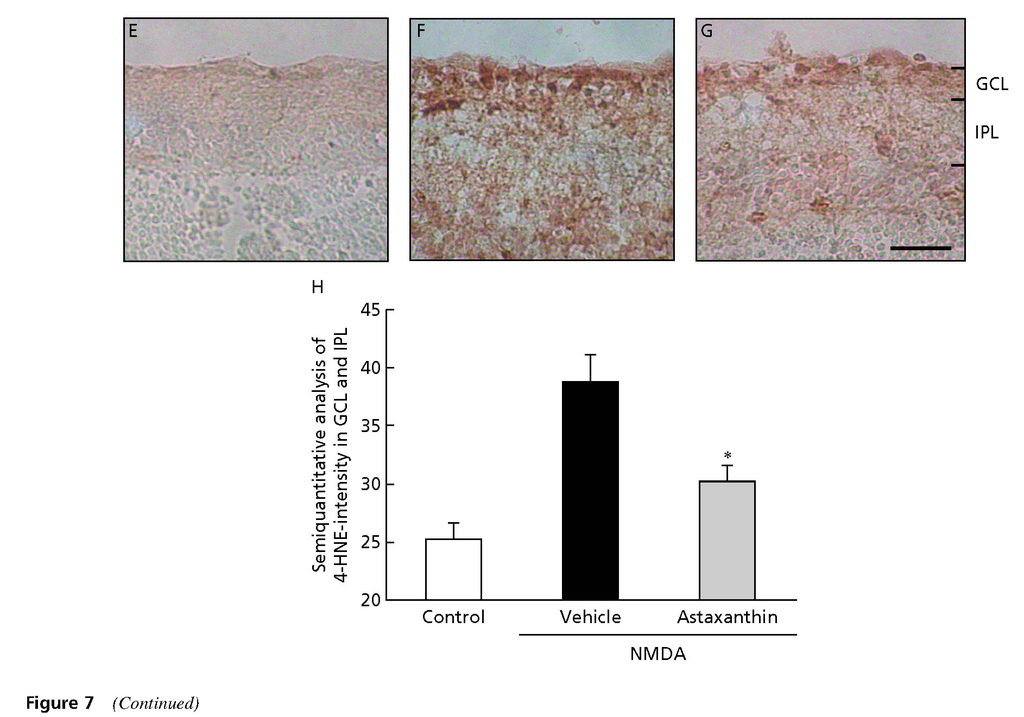 Astaxanthin, a dietary carotenoid, protects retinal cells against oxidative stress in-vitro and in mice in-vivo_頁面_09.jpg Astaxanthin, a dietary carotenoid, protects retinal cells against oxidative stress in-vitro and in mice in-vivo_頁面_09.jpg