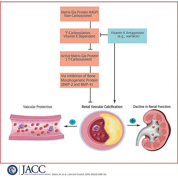 jacc_ci_061615_bohm.jpg