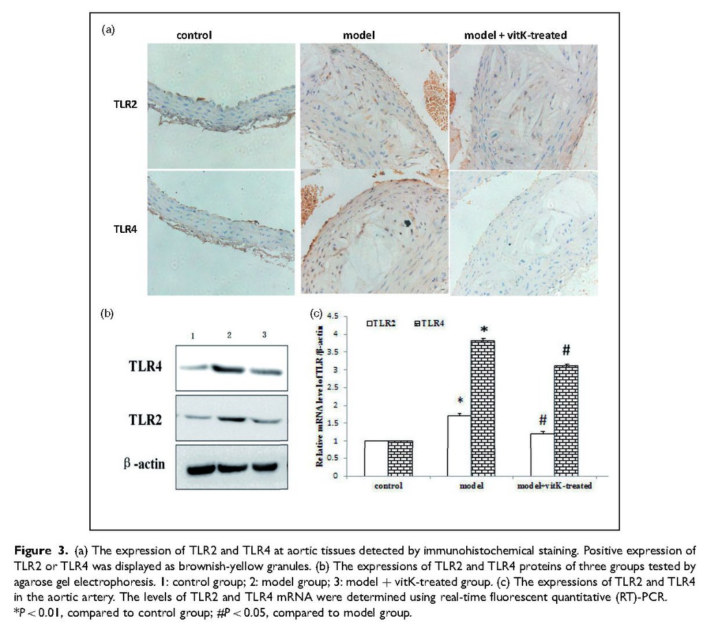 28587577 Vitamin K2 can suppress the expression of Toll-like receptor 2 (TLR2) and TLR4, and inhibit calcification of aortic intima_頁面_6.jpg