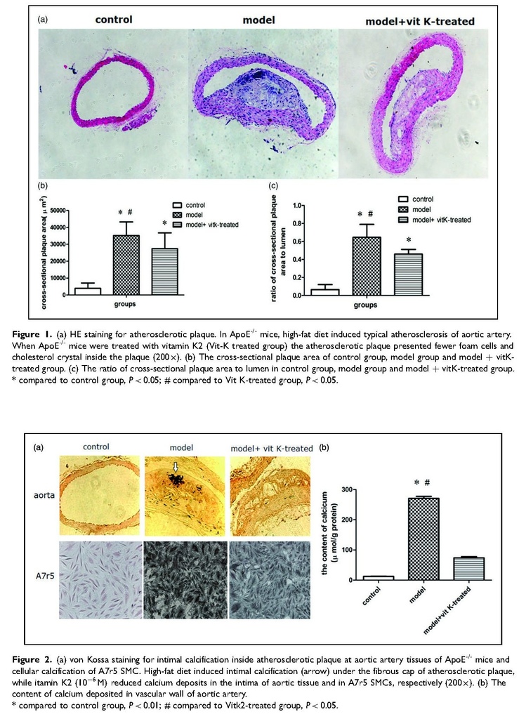 28587577 Vitamin K2 can suppress the expression of Toll-like receptor 2 (TLR2) and TLR4, and inhibit calcification of aortic intima_頁面_5.jpg