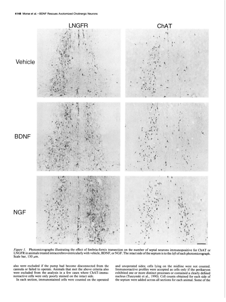 Brain-derived neurotrophic factor (BDNF) prevents the degeneration of medial septal cholinergic neurons following fimbria transection_頁面_03.jpg