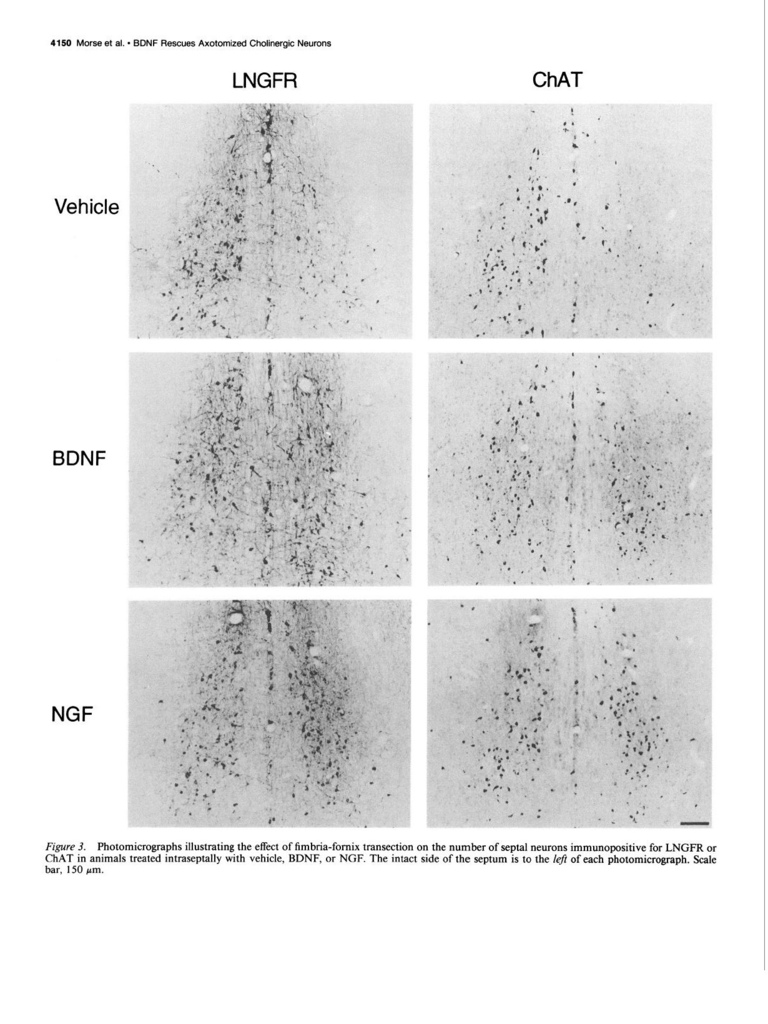 Brain-derived neurotrophic factor (BDNF) prevents the degeneration of medial septal cholinergic neurons following fimbria transection_頁面_05.jpg