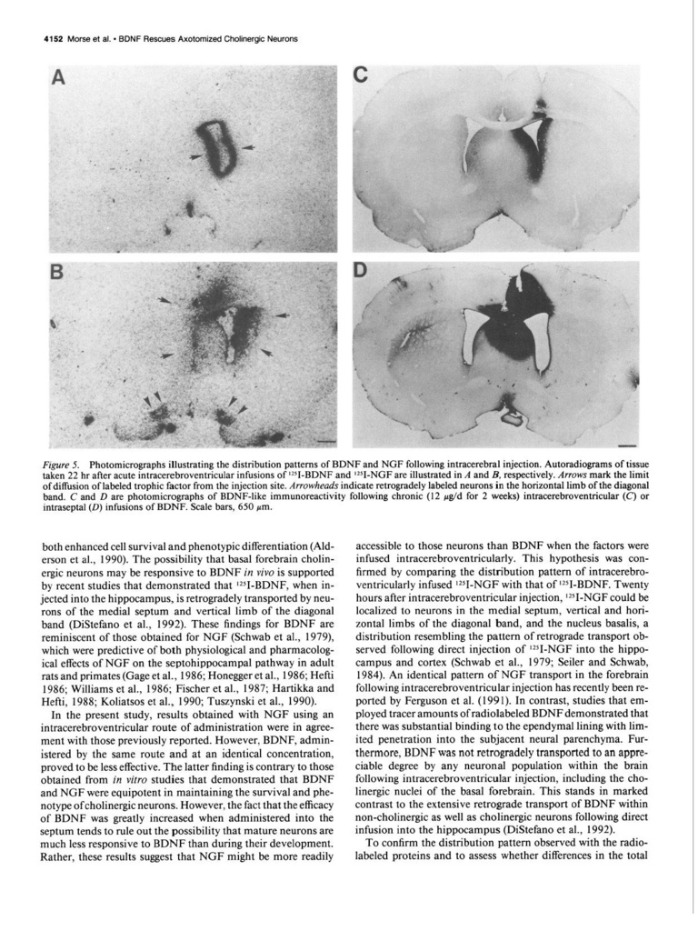 Brain-derived neurotrophic factor (BDNF) prevents the degeneration of medial septal cholinergic neurons following fimbria transection_頁面_07.jpg