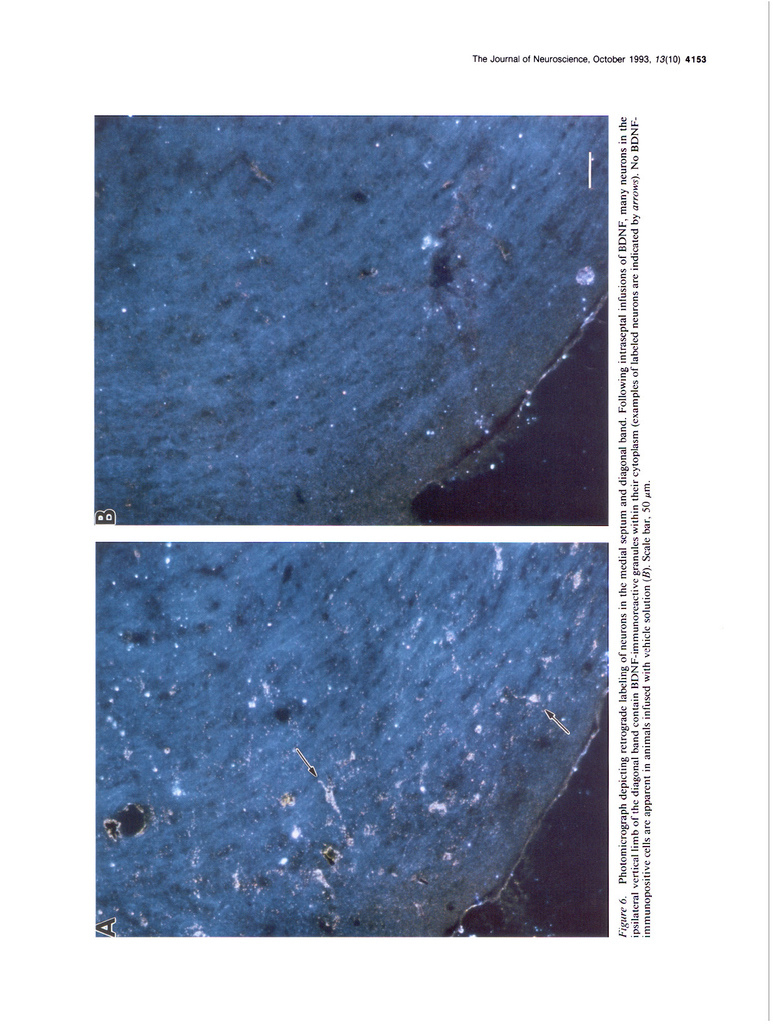 Brain-derived neurotrophic factor (BDNF) prevents the degeneration of medial septal cholinergic neurons following fimbria transection_頁面_08.jpg