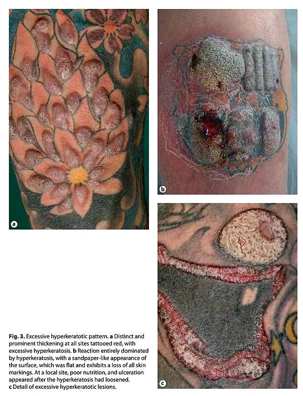 M. Shadows and Chris Jericho's pumpkin tattoo | Pumpkin tattoo, Chris  jericho, Matching tattoos