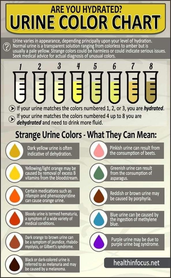 urine color chart.jpg