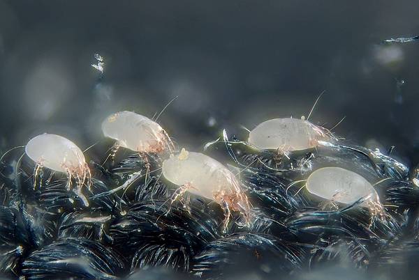 1280px-House_dust_mites_(5247996458).jpg