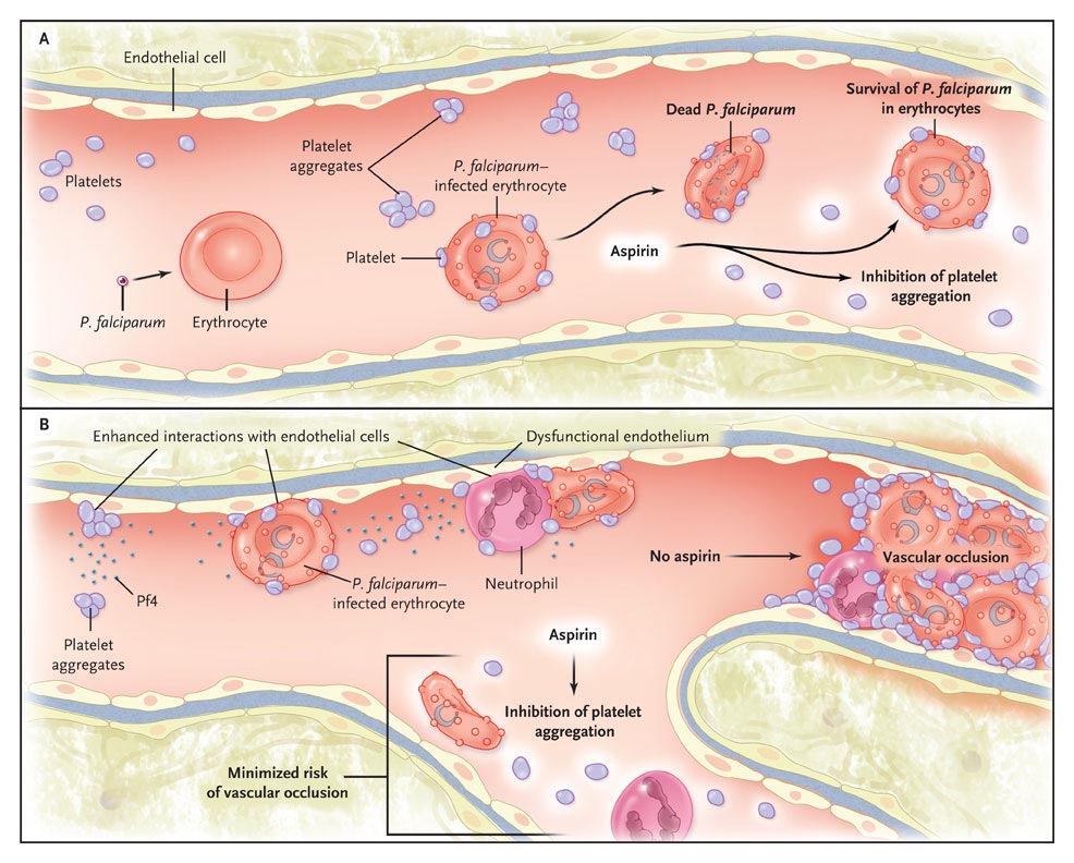 Platelet Activation in Falciparum Malaria