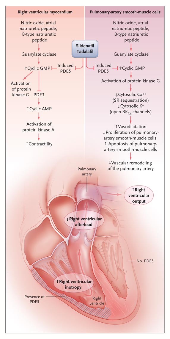 pde5