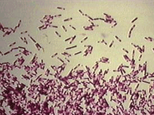 nih_clostridium_difficile_300x225.png