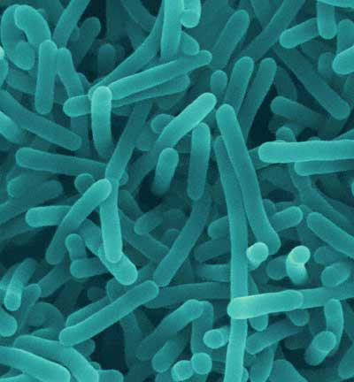 listeria-monocytogenes.jpg