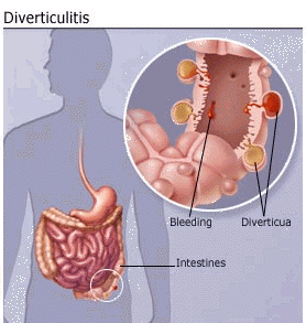 DivertDiagram.gif