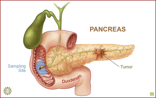 pancreatic.jpg