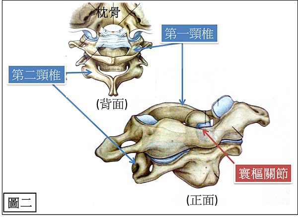 CA2