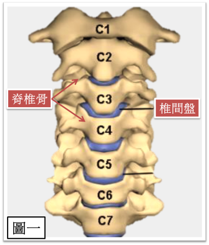 CA1