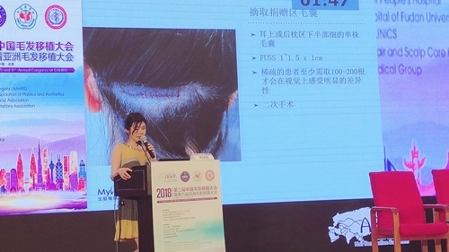 MyHair生髮植鬍1.jpg.jpg MyHair生髮植鬍1.jpg.jpg