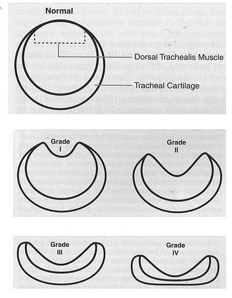 氣管塌陷分級.JPG