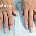 20110609 sophia姐補甲+光療上色01.jpg