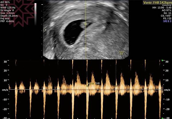 懷孕5.jpg