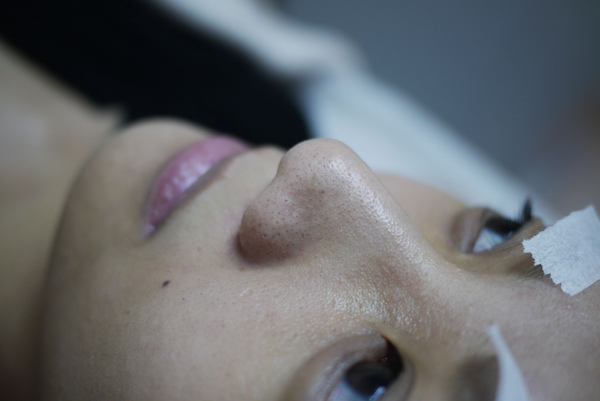 雅偲醫美診所 - 09160.jpg