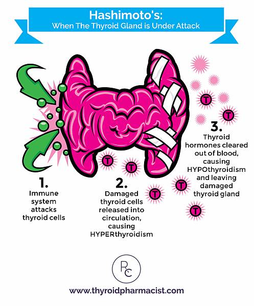 ThyroidUnderAttack-web-011.jpg