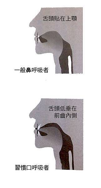 口呼吸 口呼吸