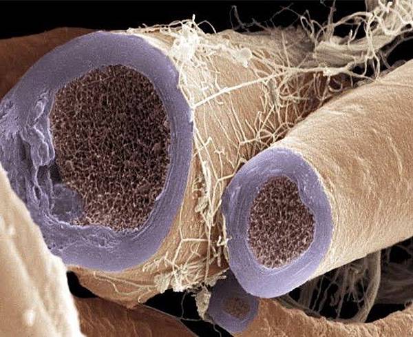 myelin sheath myelin sheath
