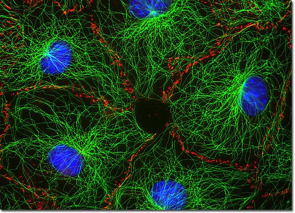 mousefibroblasts.jpg