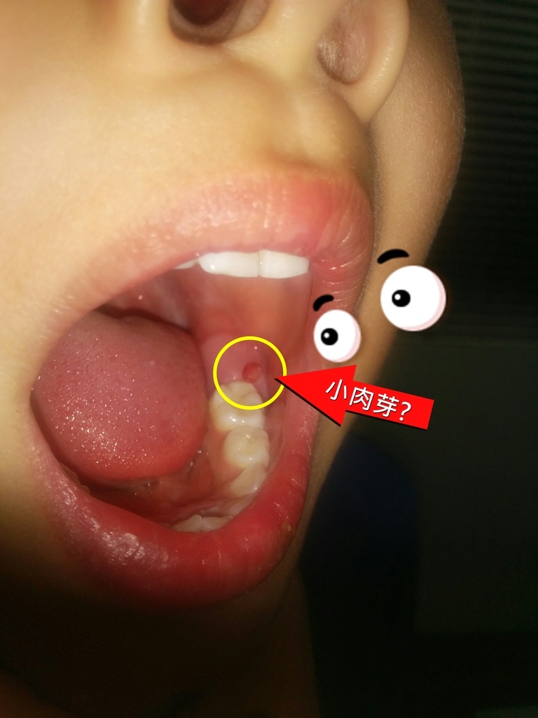 IMG_20170215_201422.jpg IMG_20170215_201422.jpg