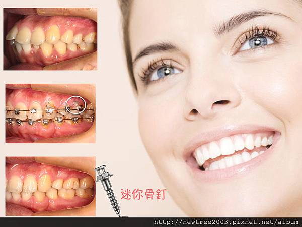 未命名 4.001 未命名 4.001