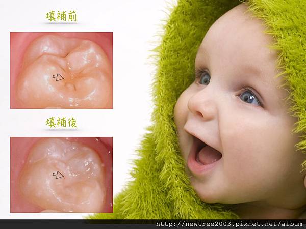 溝隙封填2.002.jpeg 溝隙封填2.002.jpeg