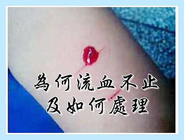為何流血不止及如何處理 常覺善緣的部落格 痞客邦 為何流血不止及如何處理 常覺善緣的部落格 痞客邦