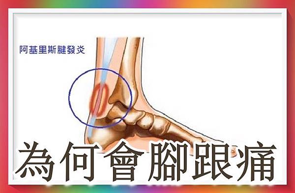 為何會腳跟痛.jpg 為何會腳跟痛.jpg