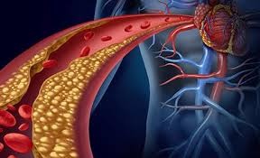 什么病能引起心髒病這四種病能引起心髒病.jpg 什么病能引起心髒病這四種病能引起心髒病.jpg