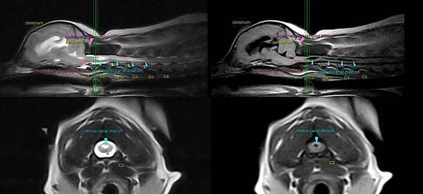 central_canal_dilation_8306_11