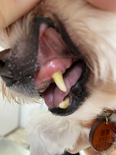 淺談牙齦炎及牙周病 病例介紹