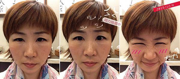 抬頭紋魚尾紋肉毒淚溝眼袋記錄20151206.jpg