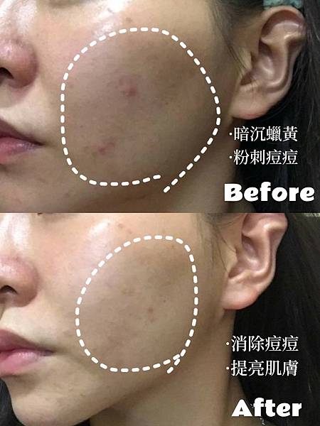 LINE_ALBUM_試用照、對比照_240125_1.jpg LINE_ALBUM_試用照、對比照_240125_1.jpg