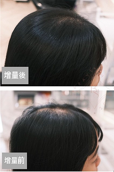 增量頭髮 「頭髮再也不稀疏!自信重燃,透過增量頭髮重拾美麗自 增量頭髮 「頭髮再也不稀疏!自信重燃,透過增量頭髮重拾美麗自