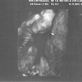 16w6d-2