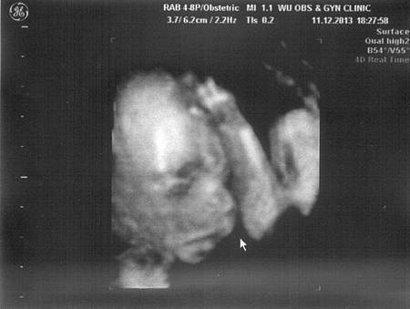 21W4D-2