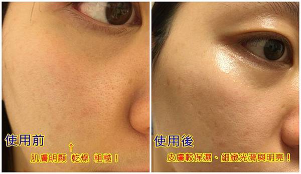 Trilogy純粹玫瑰果油5.jpg 試用