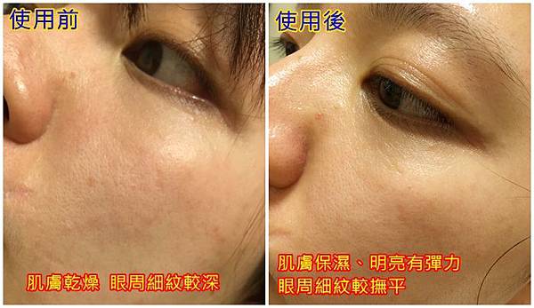 Trilogy純粹玫瑰果油 6.jpg 試用