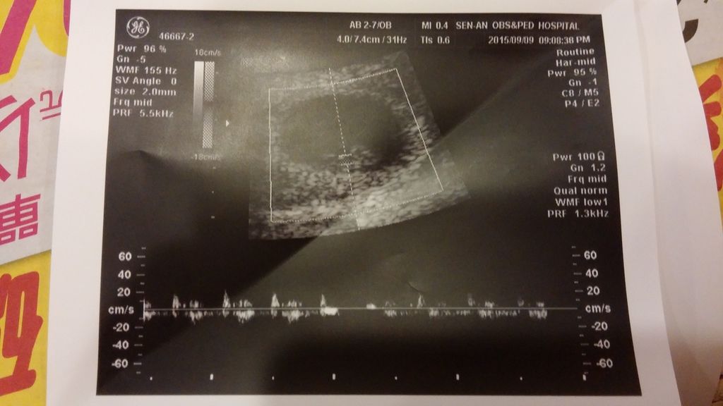 7w5d