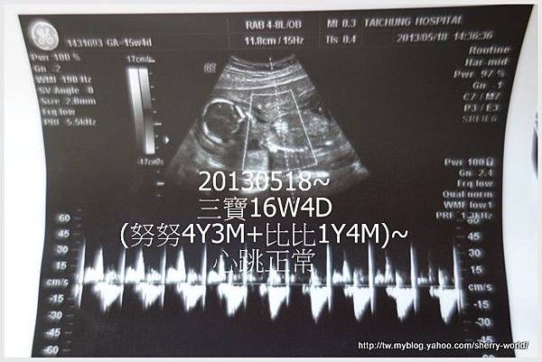 2-產檢10206~21週5.jpg 2-產檢10206~21週5.jpg