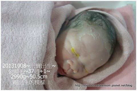 1021008生產DAY1_手術室待了三小時4.jpg 1021008生產DAY1_手術室待了三小時4.jpg