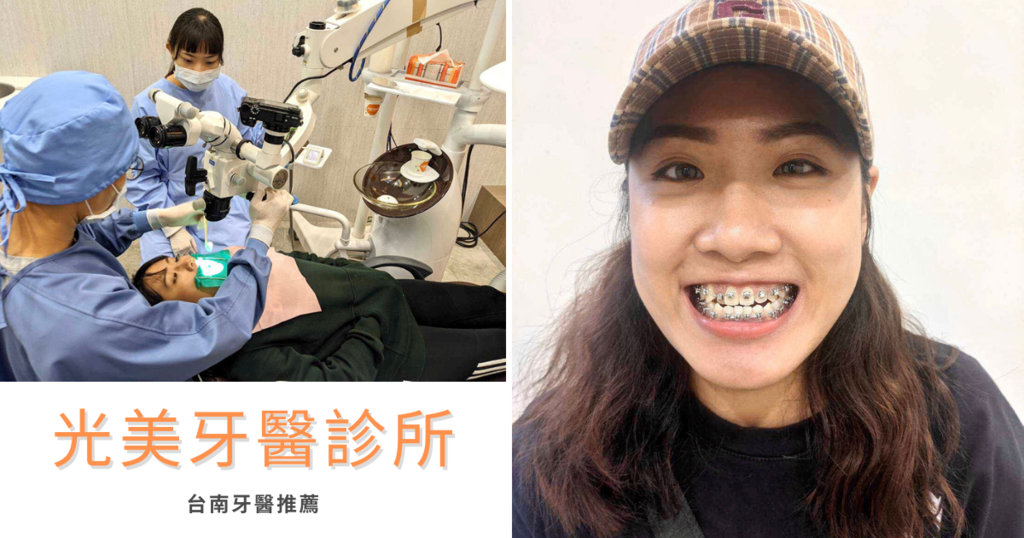 【台南牙醫診所/牙套】光美牙醫診所 / 安平戴牙套推薦 / 台南牙醫診所首選 / 細心又專業治療過程大公開
